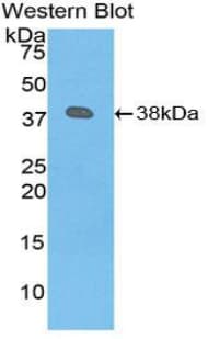 PLG / Plasmin / Plasminogen Antibody (aa274-560)