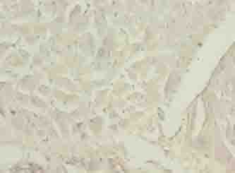 LDHD / Lactate Dehydrogenase D Antibody