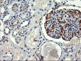 COPS6 / CSN6 Antibody (aa58-327, clone OTI4E7, Carrier-free)