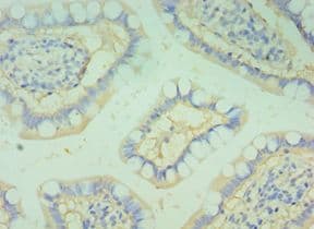 Polyclonal Rabbit anti-Human BOC Antibody (aa1-125, IHC)