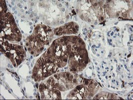 F13A1 / Factor XIIIa Antibody (clone 1H2, Carrier-free)