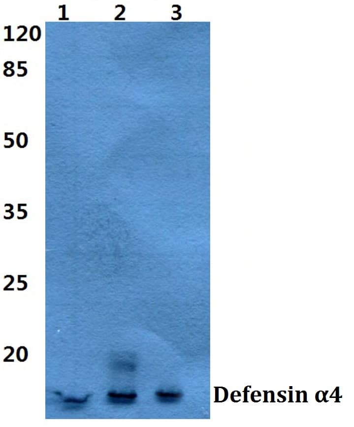 IHC-plus™ Polyclonal Rabbit anti-Human HNP-4 / DEFA4 Antibody (Asp27, IHC, WB)