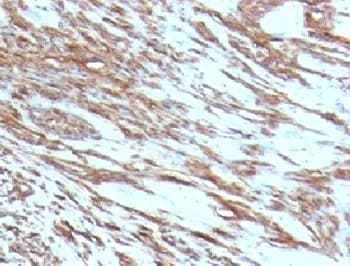 Muscle Actin Antibody (clone MSA/953)