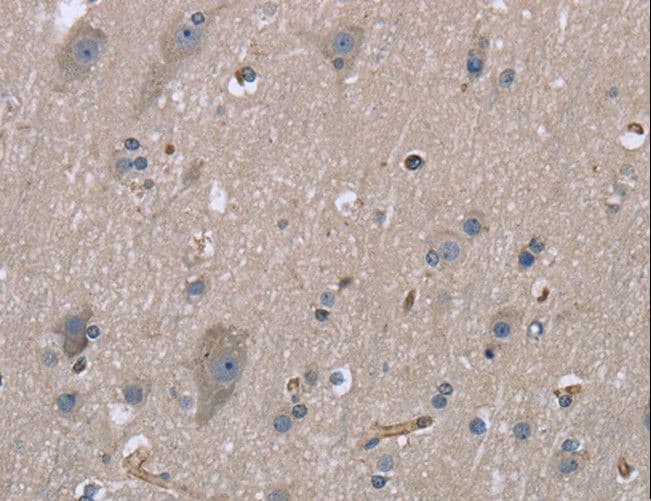 MRLC2 / MYL12B Antibody