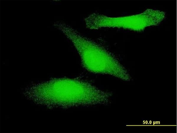 GSK3B / GSK3 Beta Antibody (clone 1H3)