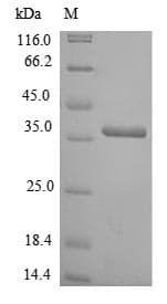 Rat GAL4 / Galectin 4 Protein (Recombinant)