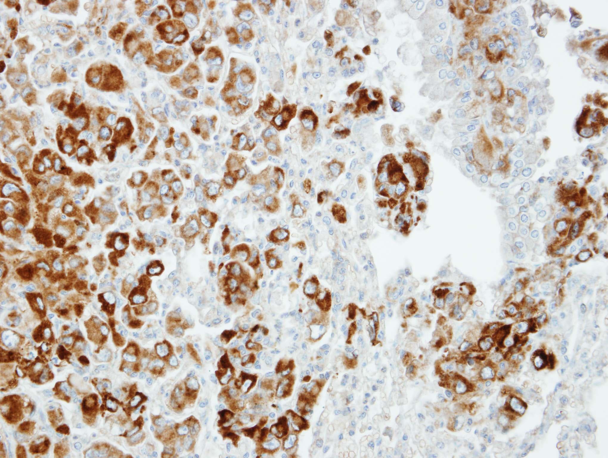 IPO13 / LGL2 Antibody (aa901-963)