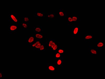 HIST1H2BB Antibody