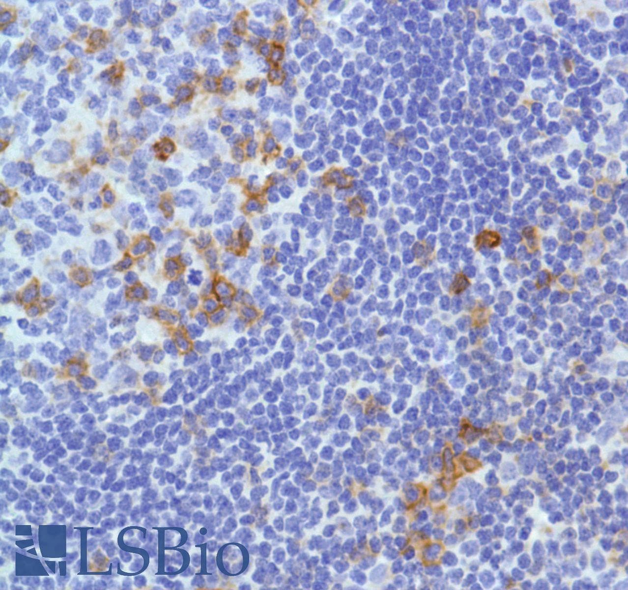 ICOS / CD278 Antibody (C-Terminus, clone SP98)