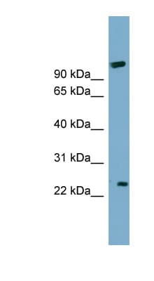 ARL8B Antibody (aa71-120)