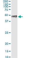 Monoclonal Mouse anti-Human PITX1 Antibody (clone 5G4, WB)