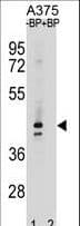 OR5AC2 / HSA1 Antibody (aa246-274)