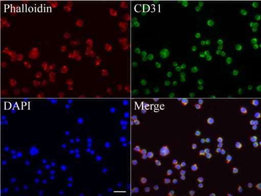 FCER2 / CD23 Antibody (aa48-321, clone UMAB101)