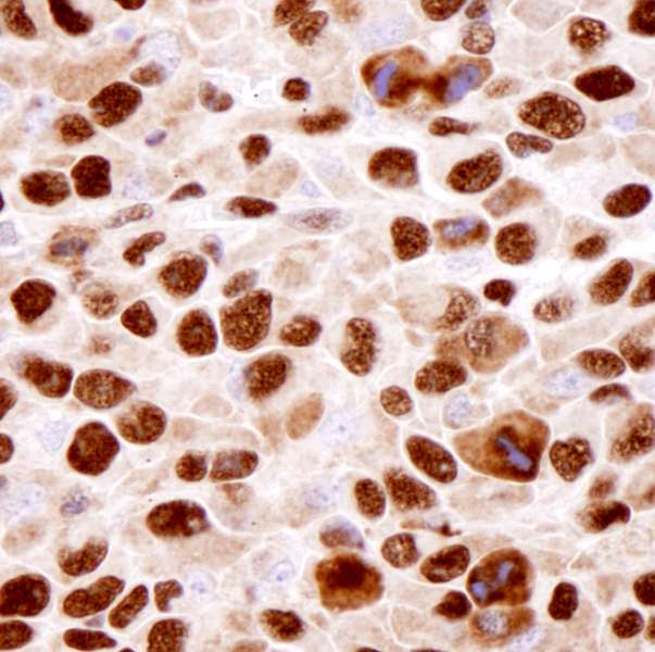 Polyclonal Rabbit anti-Human HNRNPK / hnRNP K Antibody (C-Terminus, IHC)