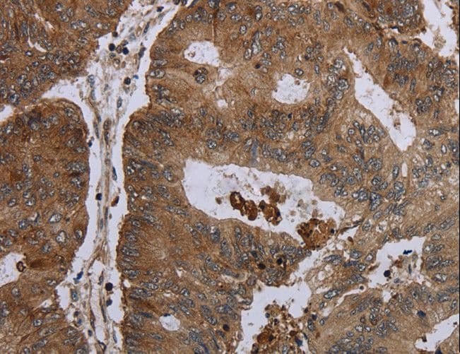 FOLH1B Antibody