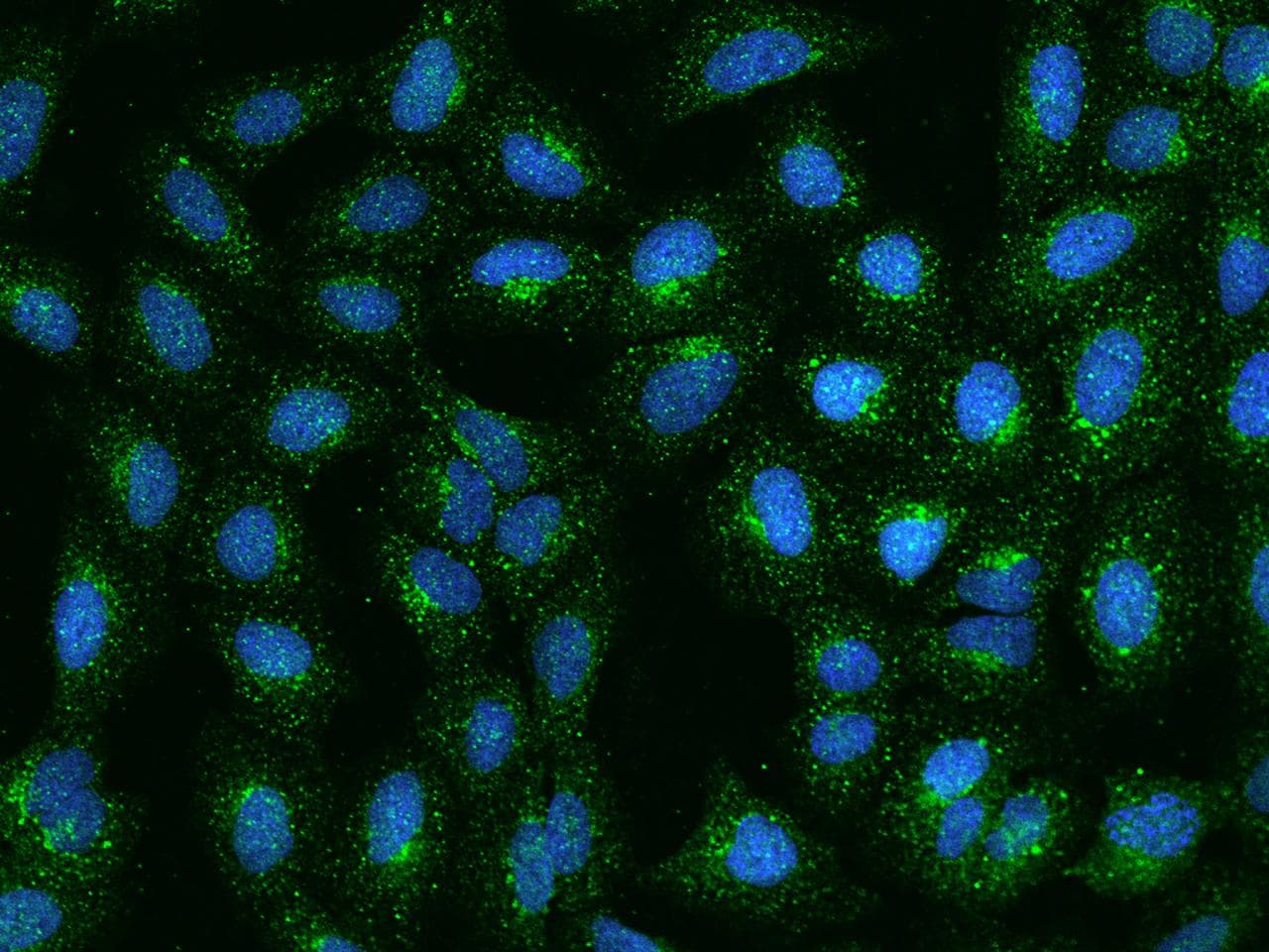 RRAGB / RAGB Antibody