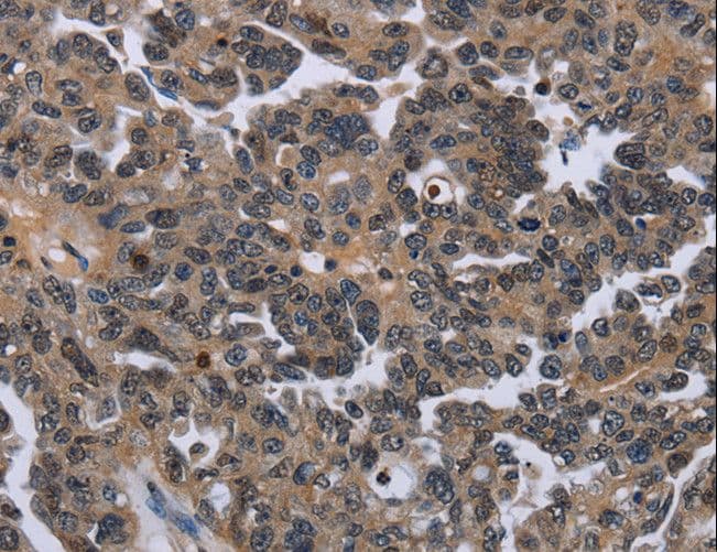 ITGAE / CD103 Antibody
