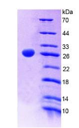 Human PTPRF Protein (Recombinant His, N-Terminal)