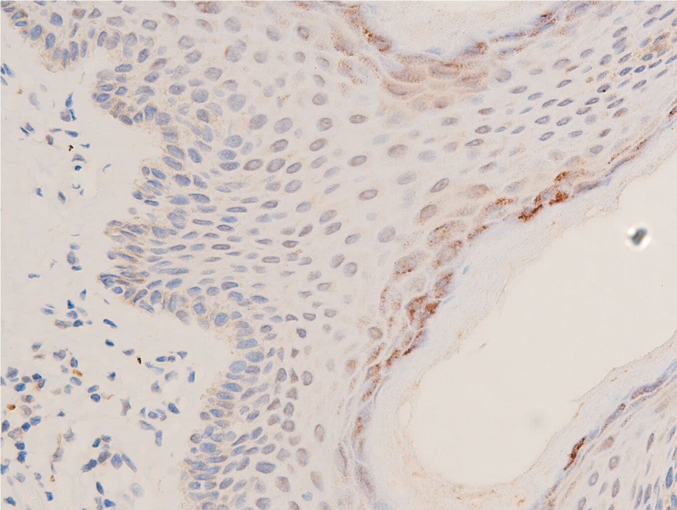 TP53 / p53 Antibody (Acetyl-Lys317)