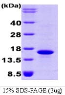 Human BMP7 Protein (Recombinant His)