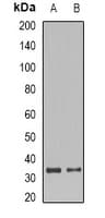 SET / TAF-I Antibody