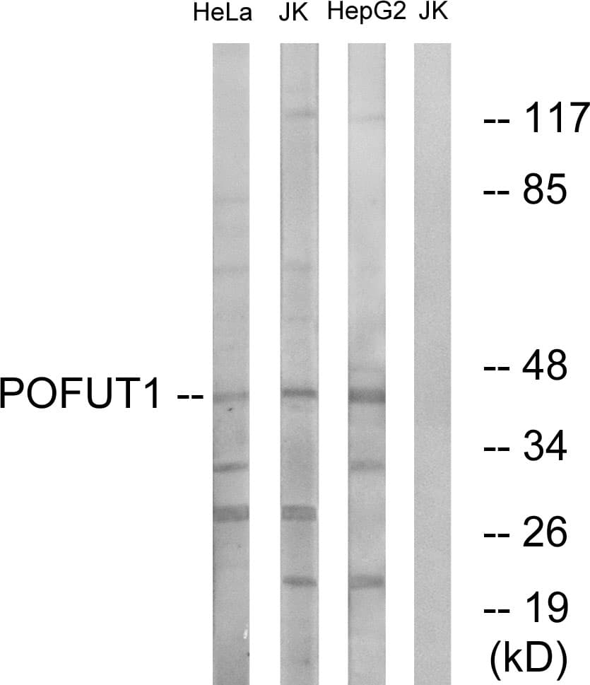 Polyclonal Rabbit anti-Human POFUT1 Antibody (aa331-380, IHC, WB)