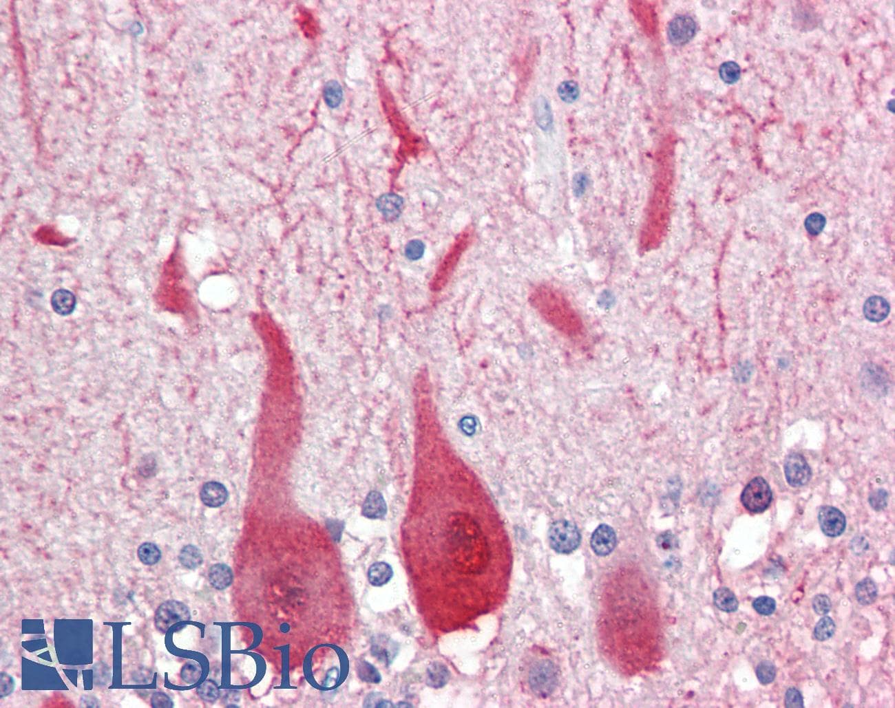 PathPlus™ ALDOC / Aldolase C Antibody (aa300-333)