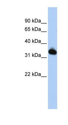GALM / Mutarotase Antibody (aa36-85)