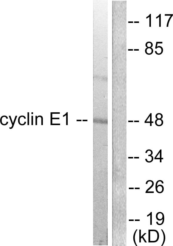 PathPlus™ CCNE1 / Cyclin E1 Antibody (aa91-140)