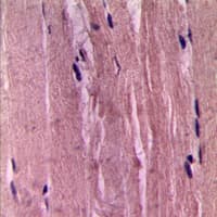 ACTA2 / Smooth Muscle Actin Antibody (N-Terminus)