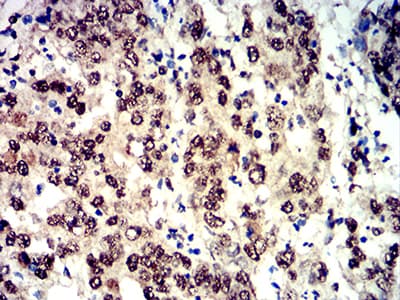 EIF4EBP1 / 4EBP1 Antibody (phospho-Ser65, clone 2D1G11)