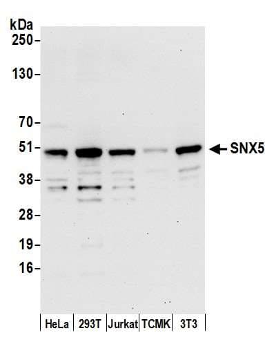 Polyclonal Rabbit anti-Human SNX5 Antibody (aa1-50, WB)