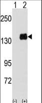 Polyclonal Rabbit anti-Human PUM1 Antibody (Tyr83, IHC, WB)