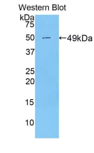 PRDX3 / Peroxiredoxin 3 Antibody (aa64-257)