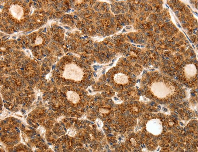 Polyclonal Rabbit anti-Human TEK / TIE2 Antibody (IHC)