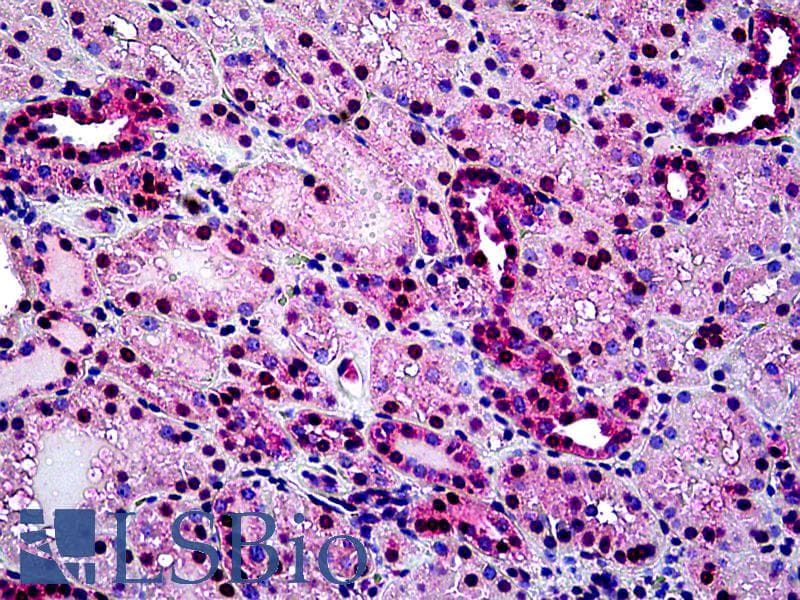 IHC-plus™ TINF2 Antibody (aa341-354)