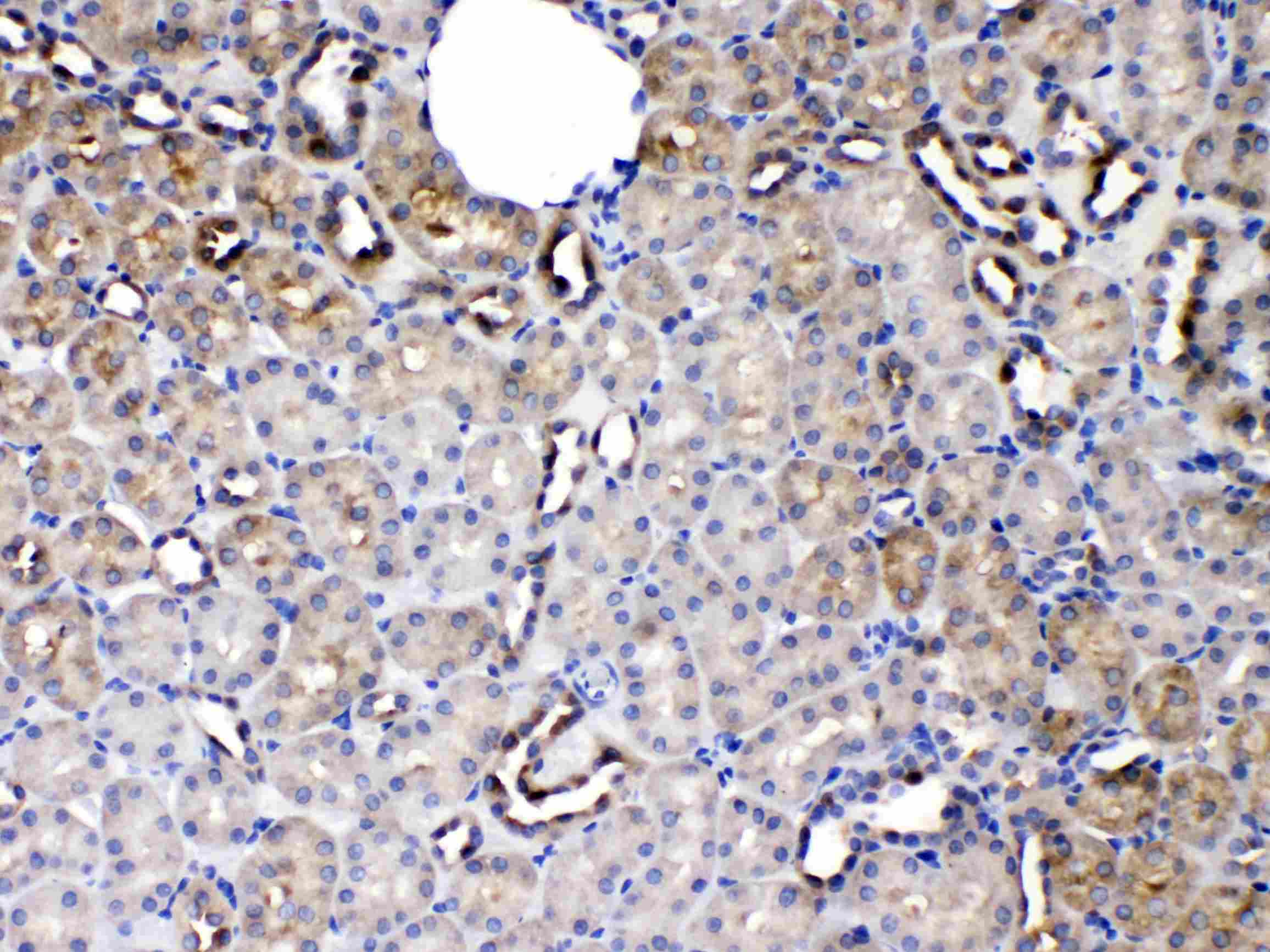 SERPINA5 / PCI Antibody