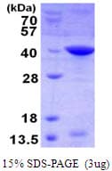 Human BIRC7 / Livin Protein (Recombinant His)