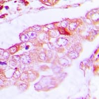 Polyclonal Rabbit anti-Human TUBA4A / TUBA1 Antibody (IHC, IF, WB)