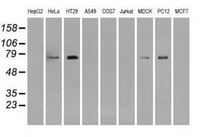 Monoclonal Mouse anti-Human RIP1 / RALBP1 Antibody (clone OTI11B2, IHC, IF, WB)