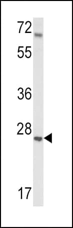 Polyclonal Rabbit anti-Human IGFBP4 Antibody (aa66-92, WB)