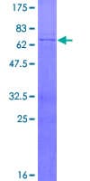 Human MECR Protein (Recombinant GST)