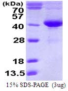 Human SDSL / Serine Dehydratase-Like Protein (Recombinant His)
