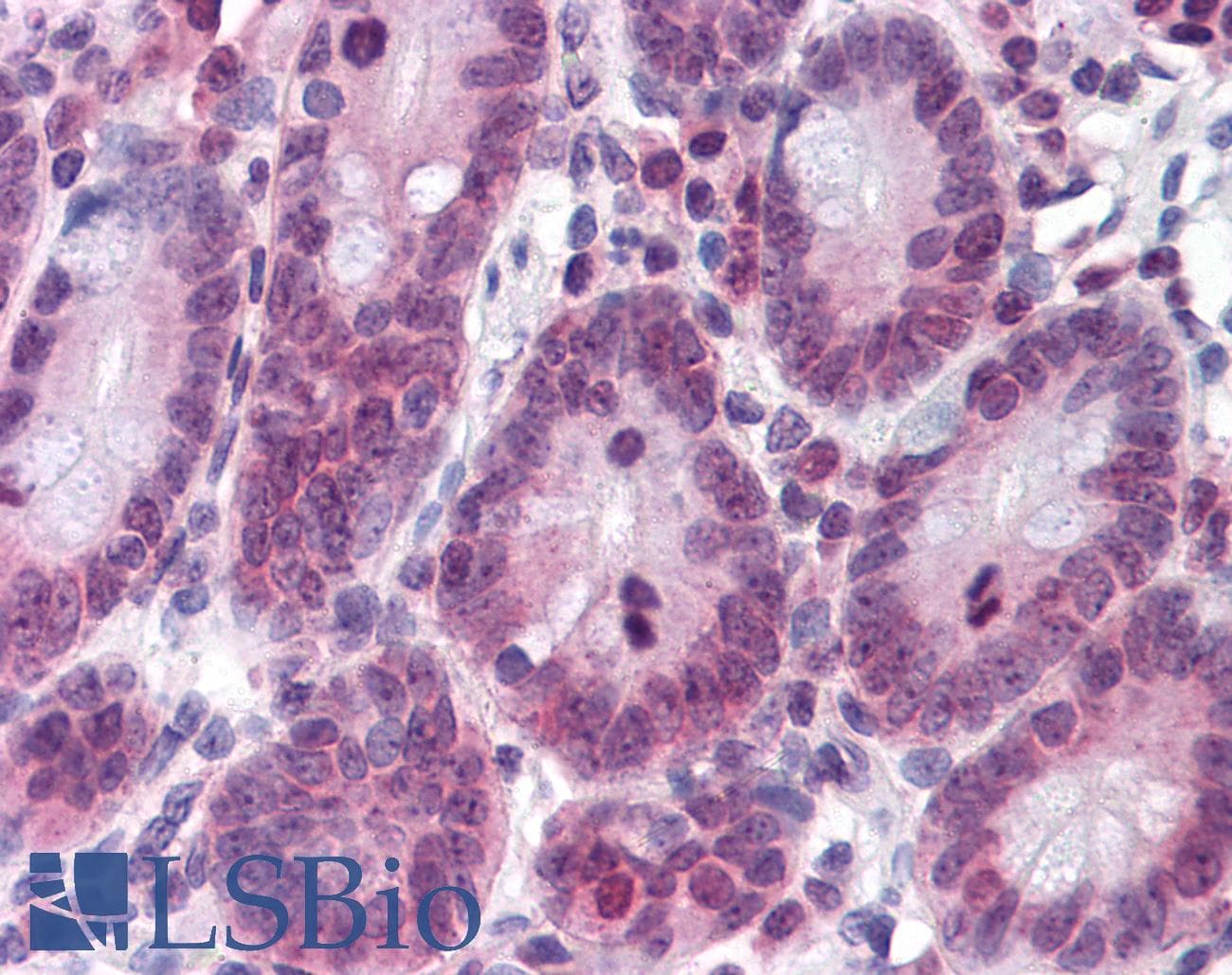 IHC-plus™ Monoclonal Mouse anti-Human RPL39L Antibody (clone 4A8-1B6, IHC, WB)