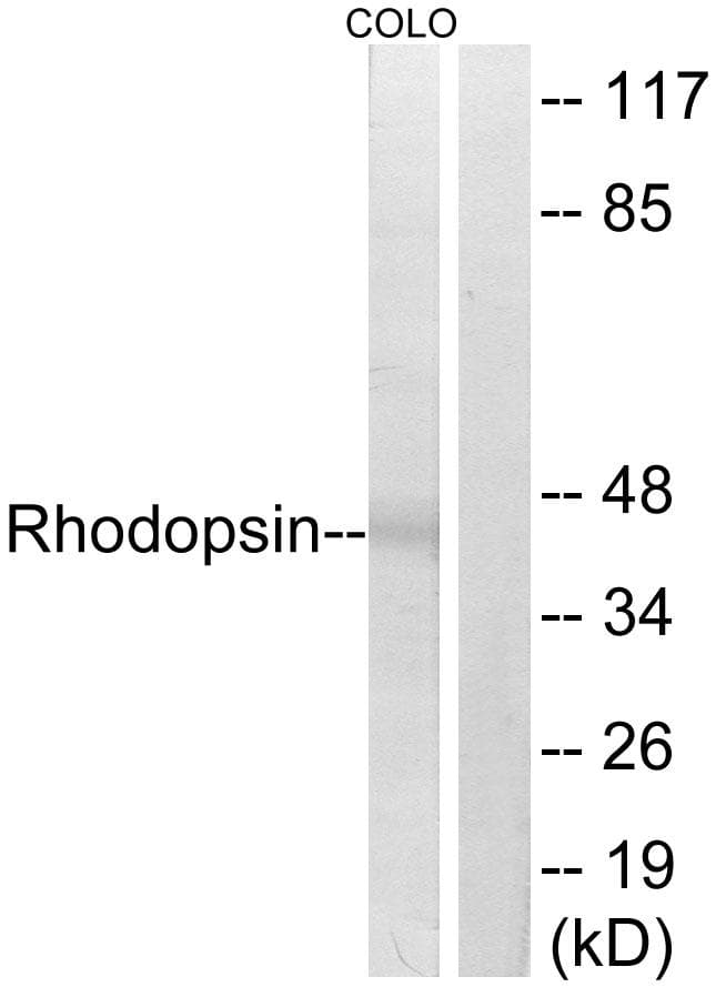 Rhodopsin / RHO Antibody (p334)