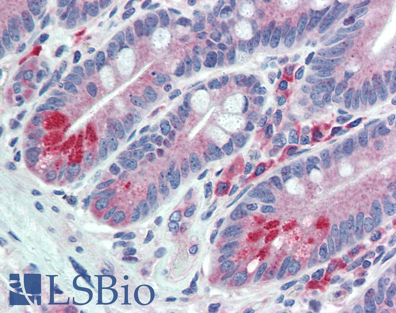 IHC-plus™ ESYT1 Antibody (Internal)