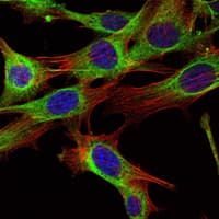 ABL2 Antibody (aa288-539, clone 1H1)