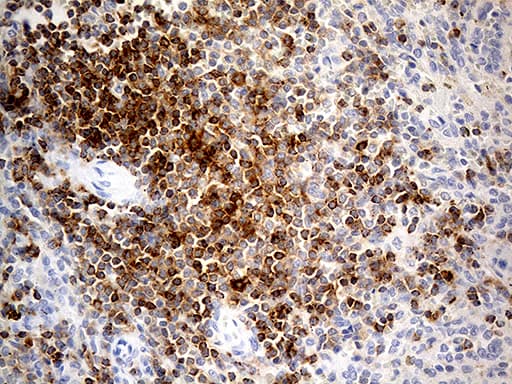 LY9 / CD229 Antibody (aa48-454, clone OTI2H4, Carrier-free)