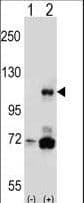 PIK3CB / PI3K Beta Antibody (aa124-154)