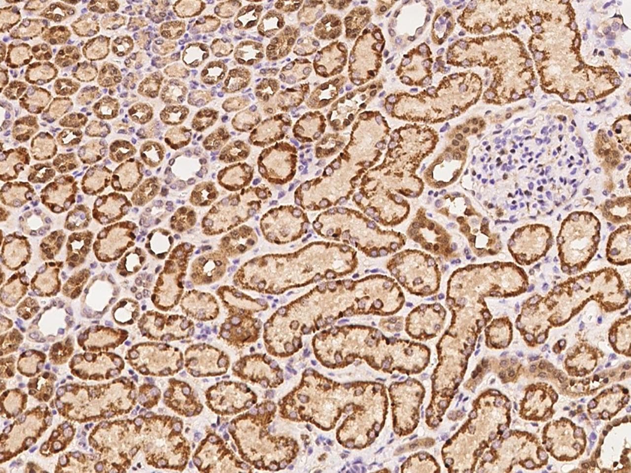 MAP2K3 / MEK3 / MKK3 Antibody (Preservative Free)